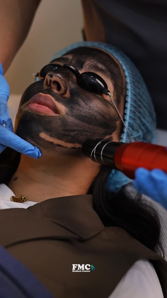 Carbon Laser Peel at FMC Medical Center